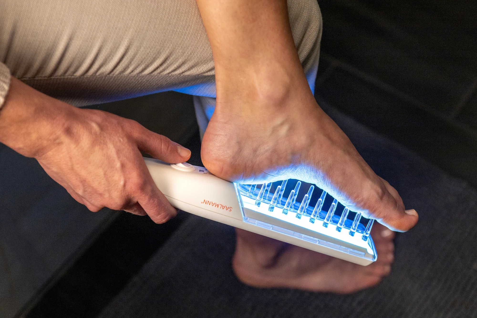 Sichtbar gesündere Haut mit dem Saalux® UV-Kamm durch die Behandlung der Fußsohlen